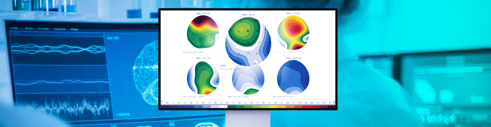 Monitor wyświetlający kolorowe mapy mózgu brain mapping QEEG w gabinecie Neurodiagnostyka.