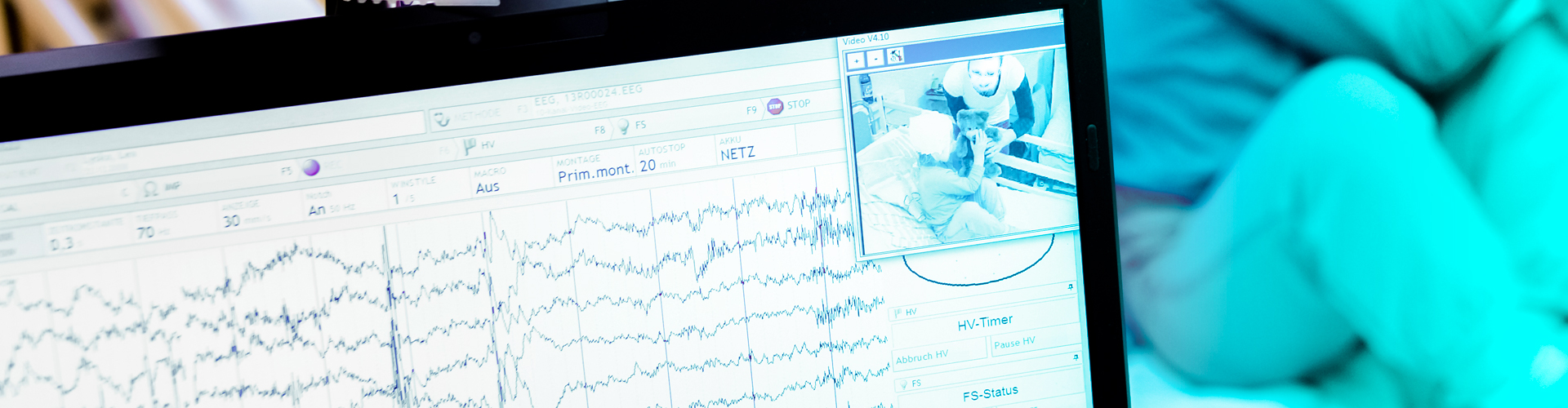 Kobieta podczas badania Wideo EEG w domu – pacjentka odpoczywa na kanapie z założonym czepkiem diagnostycznym.