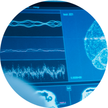 Wynik badania EEG przedstawiający fale mózgowe